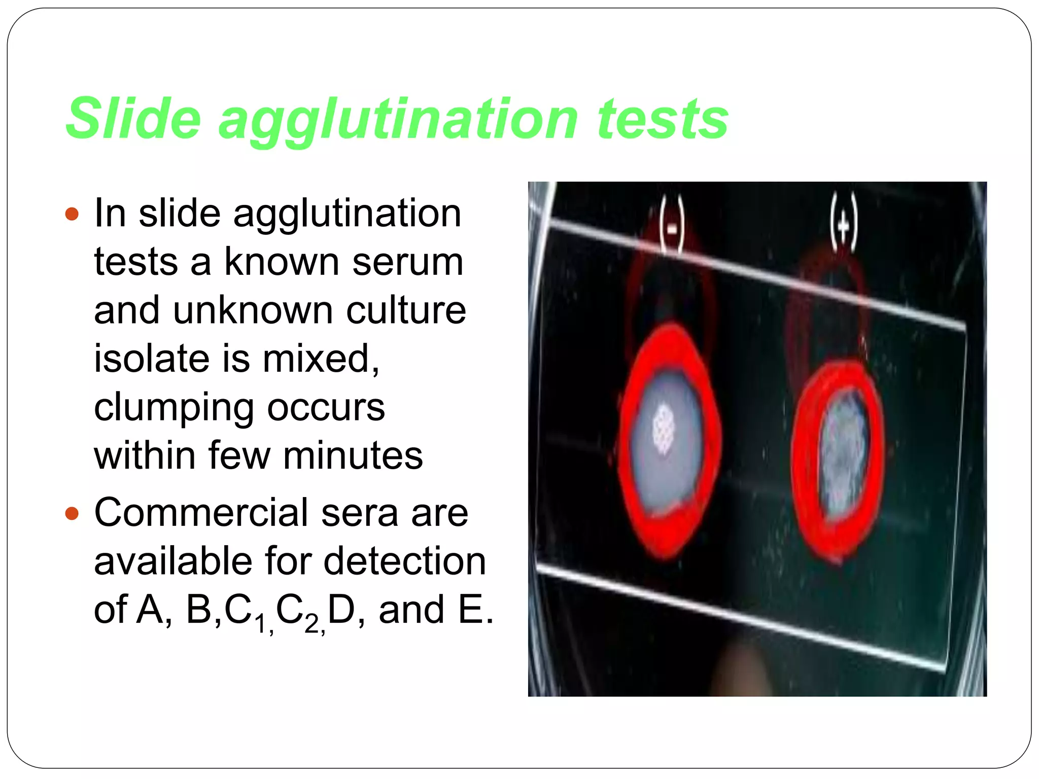 Slide agglutination tests
 In slide agglutination
tests a known serum
and unknown culture
isolate is mixed,
clumping occurs
within few minutes
 Commercial sera are
available for detection
of A, B,C1,C2,D, and E.
 