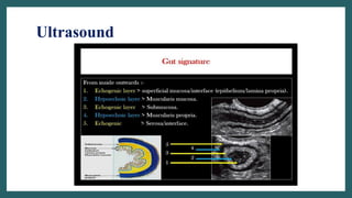Ultrasound
 