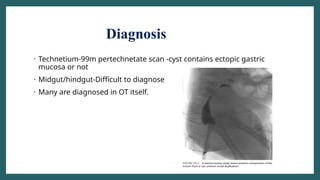 Diagnosis
• Technetium-99m pertechnetate scan -cyst contains ectopic gastric
mucosa or not
• Midgut/hindgut-Difficult to diagnose
• Many are diagnosed in OT itself.
 