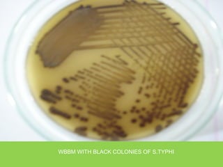 WBBM WITH BLACK COLONIES OF S.TYPHI
 