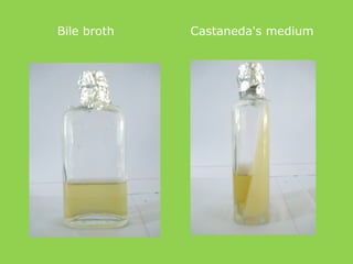 Bile broth Castaneda's medium
 