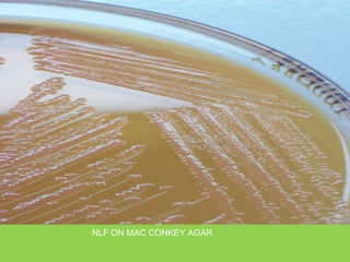 NLF ON MAC CONKEY AGAR
 