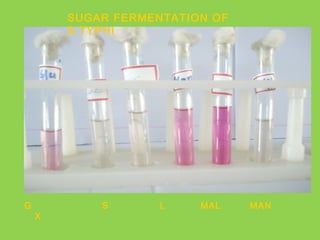 SUGAR FERMENTATION OF
S.TYPHI
G S L MAL MAN
X
 
