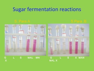Sugar fermentation reactions
G L S MAL MN
X
G L S X MAN
MAL X
S. Para A S.Para .B
 