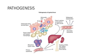 PATHOGENESIS
 