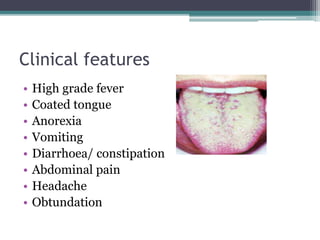 Clinical features
• High grade fever
• Coated tongue
• Anorexia
• Vomiting
• Diarrhoea/ constipation
• Abdominal pain
• Headache
• Obtundation
 