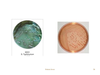 Enteric fever 24
 