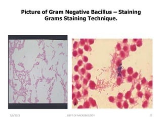 Picture of Gram Negative Bacillus – Staining
Grams Staining Technique.
7/8/2021 DEPT OF MICROBIOLOGY 27
 