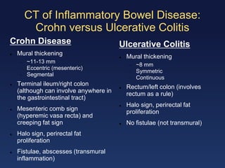 Enteritis and colitis | PDF