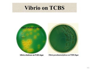 Vibrio on TCBS
111
 