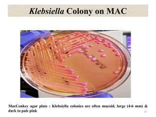 Klebsiella Colony on MAC
23
MacConkey agar plate : Klebsiella colonies are often mucoid, large (4-6 mm) &
dark to pale pink
 