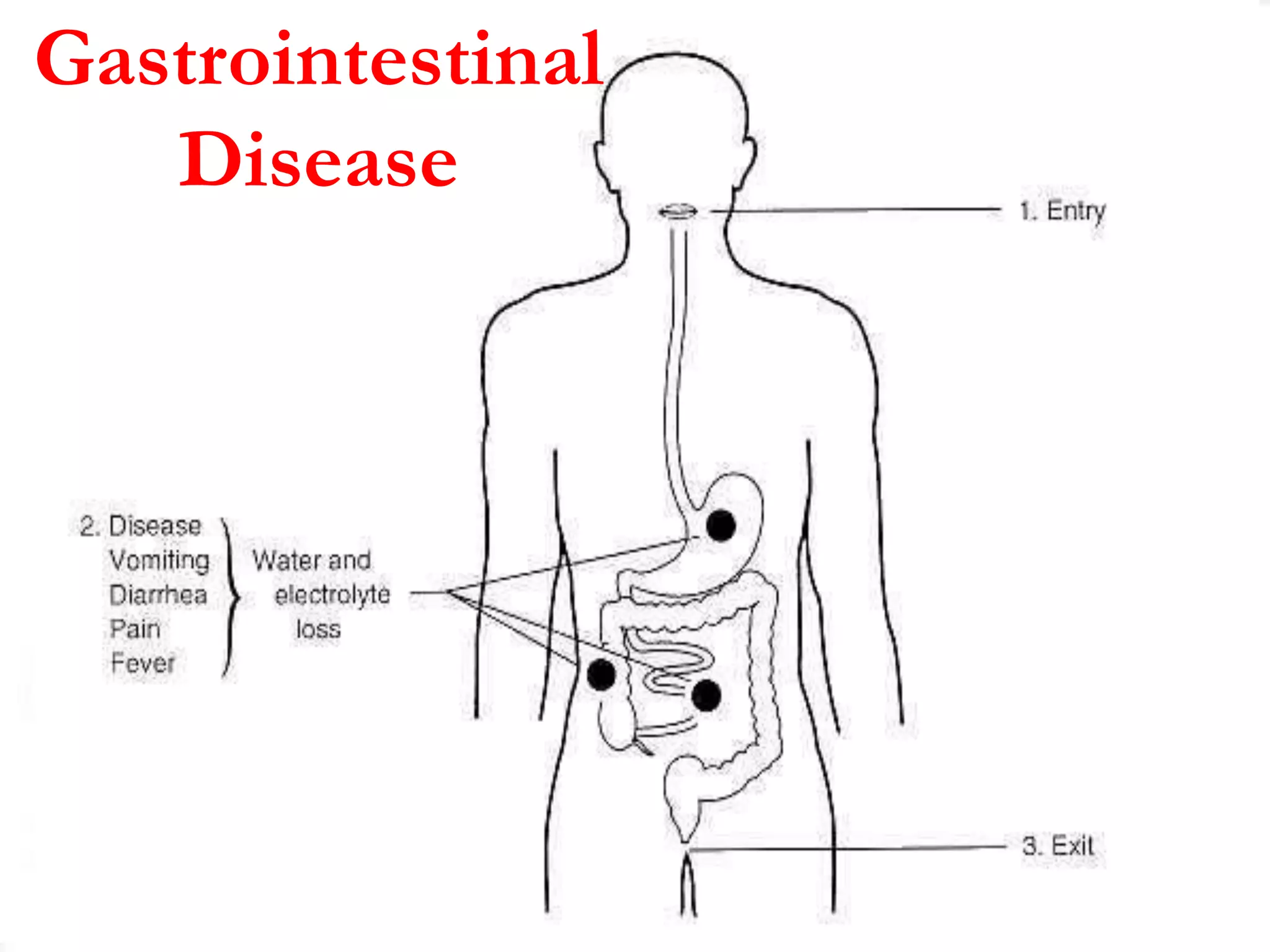 Gastrointestinal
Disease
 
