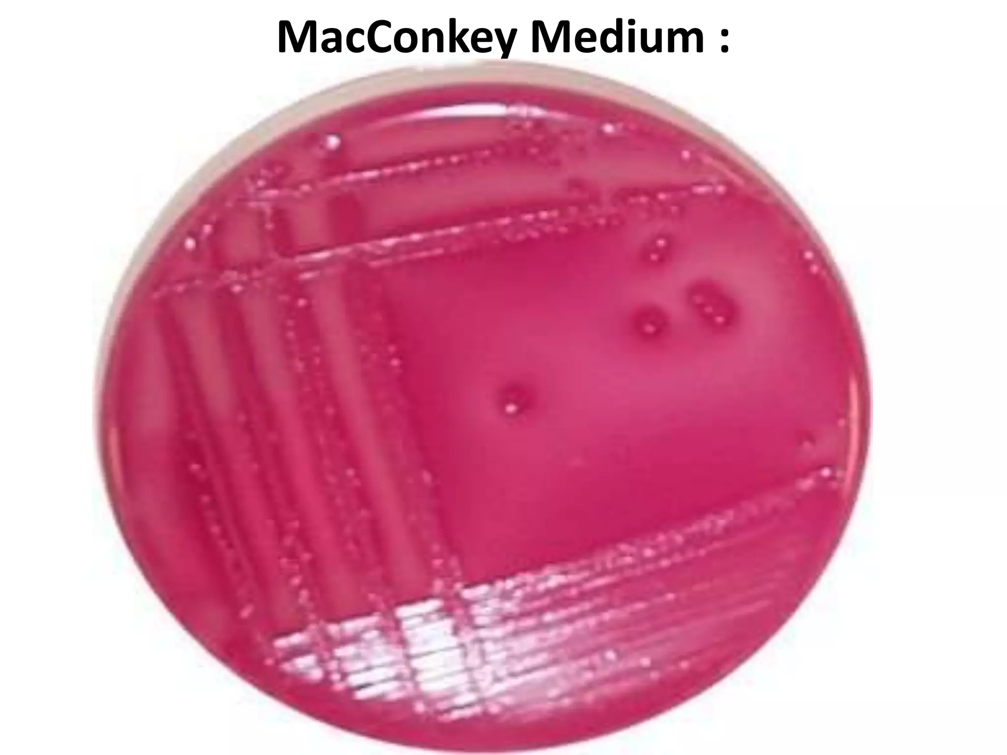 MacConkey Medium :
 