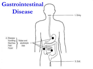 Gastrointestinal
Disease
 