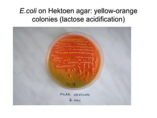 E.coli on Hektoen agar: yellow-orange
colonies (lactose acidification)
 