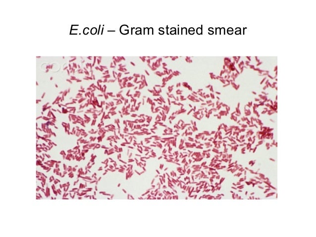 Enterobacteriaceae