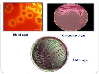 Blood agar Macconkey Agar
EMB agar
 