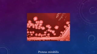 Proteus mirabilis
 