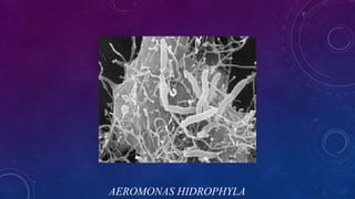 AEROMONAS HIDROPHYLA
 