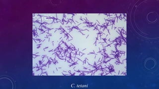 C. tetani
 