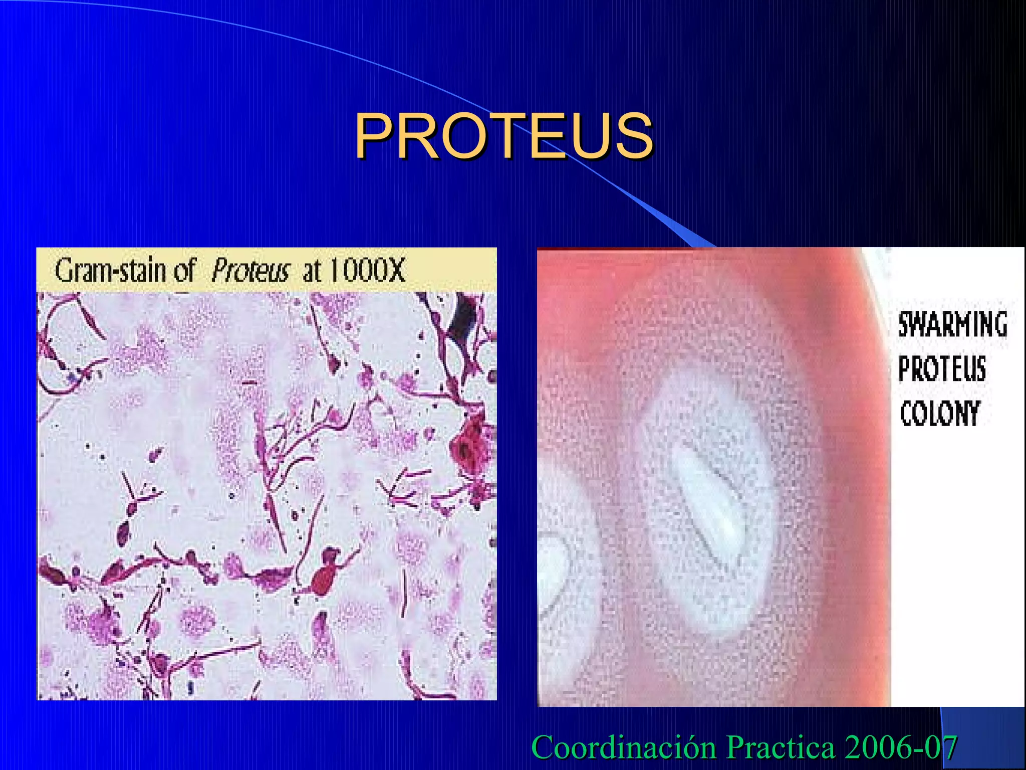 PROTEUS




    Coordinación Practica 2006-07
 