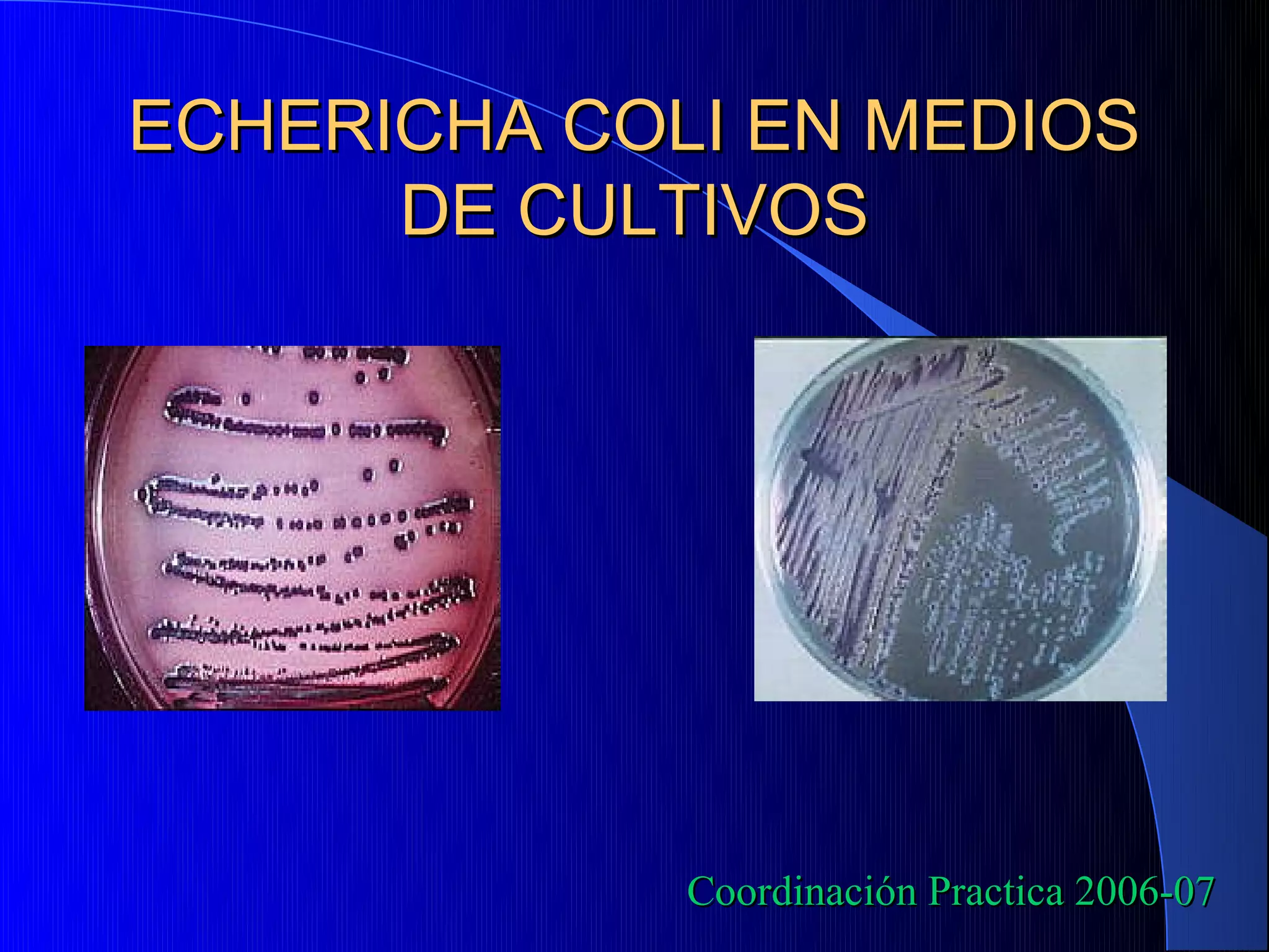 ECHERICHA COLI EN MEDIOS
      DE CULTIVOS




             Coordinación Practica 2006-07
 