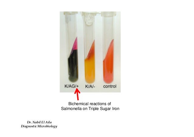 Enterobacteriacea ii biochemical reaction 2بكتريا عملي
