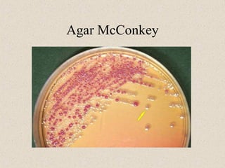 Agar McConkey
