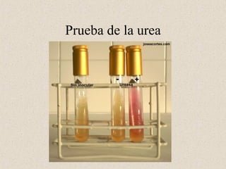 Prueba de la urea