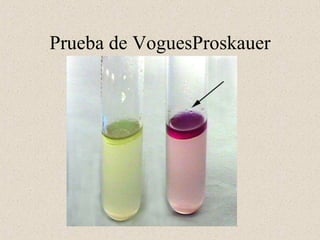 Prueba de VoguesProskauer