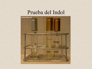 Prueba del Indol