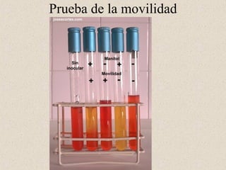 Prueba de la movilidad