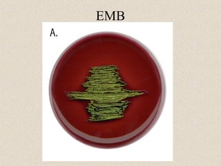 EMB