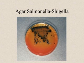 Agar Salmonella-Shigella