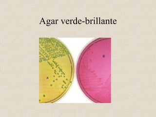Agar verde-brillante