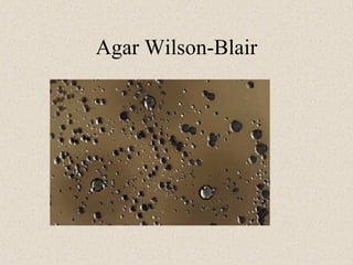 Agar Wilson-Blair