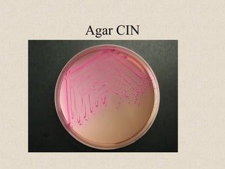 Agar CIN