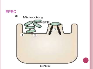 EPEC

 