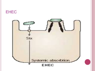 EHEC

 