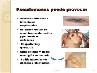 Pseudomonas puede provocar Abscesos cutáneos e infecciones respiratorias.  De menor relevancia encontramos dermatitis y perionixis en nadadores Conjuntivitis y queratitis Otitis externa y media, meningitis secundaria Colitis necrotizante Abscesos intestinales .  11/20/11 