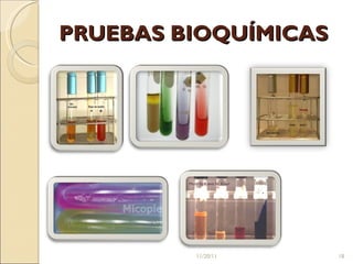 PRUEBAS BIOQUÍMICAS 11/20/11 