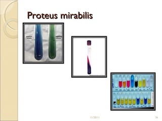 Proteus mirabilis 11/20/11 