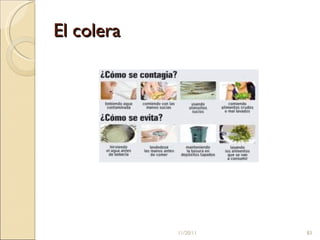 El colera 11/20/11 
