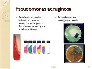 Pseudomonas aeruginosa Se cultivan en medios selectivos como las enterobacterias pero no fermentan azucares y son oxidasa positivos.  Es productora de exopigmento verde 11/20/11 