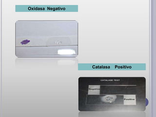 Oxidasa Negativo




                   Catalasa   Positivo
 