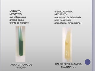 •CITRATO              •FENIL ALANINA
NEGATIVO.             NEGATIVO.
(no utiliza sales     (capacidad de la bacteria
amonio como           para desaminar
fuente de nitrgeno)   aminoácido fenilalamina)




AGAR CITRATO DE       CALDO FENIL ALANINA-
   SIMONS.                MALONATO .
 