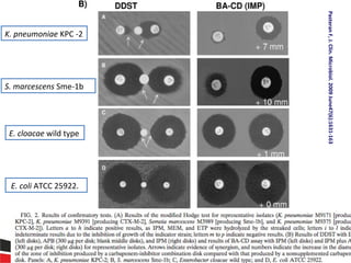S. marcescens Sme-1b

E. cloacae wild type

E. coli ATCC 25922.

Pasteran F, J. Clin. Microbiol. 2009 June47(6):1631-163

Detección por laboratorio

K. pneumoniae KPC -2

 
