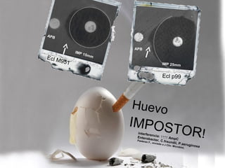 APB

Ecl M
951

IMP
15

APB
mm
IMP 25mm

Ecl p99

Huevo

IMPOS

TOR!

interfer
en
Enterob cia: ↑↑↑↑ Amp
C
acter, C
Pastera
.freund
n F., en
ii, P.aer
viado a
J Clin.
uginos
Micro
a
biol,

 