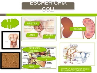 IT
U
ESCHERICHIA
COLI
EVITAN LA ELIMINACION DE LAS
BACTERIAS EN LA MICCIÓN
URETRA
VEJIG
A
RIÑON
PROSTAT
A
ANO
ANO
ORIFICIO
URETRAL
 