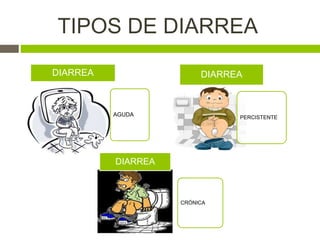 TIPOS DE DIARREA
AGUDA
DIARREA
PERCISTENTE
DIARREA
CRÓNICA
DIARREA
 